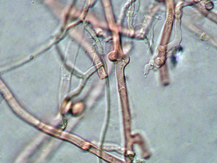 Haplotrichum da determinare